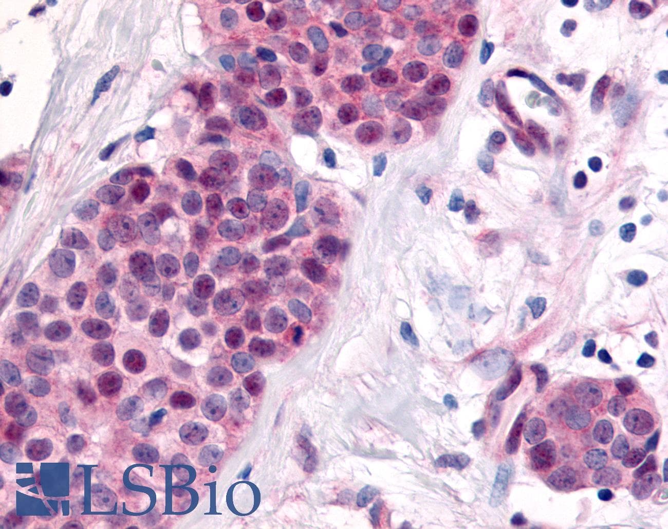 PathPlus™ NR2E1 / TLX Antibody (N-Terminus)