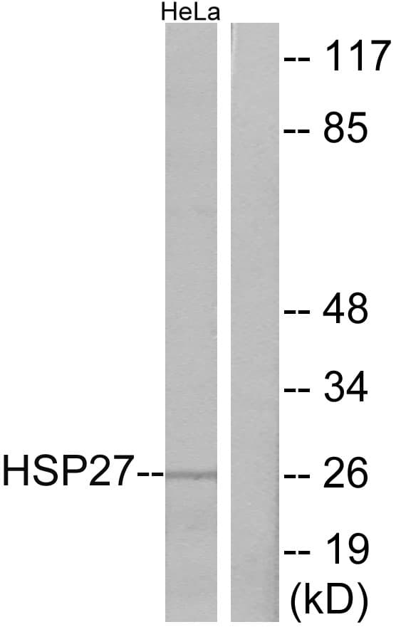 PathPlus™ HSPB1 / HSP27 Antibody (aa48-97)