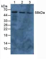 PKM / Pyruvate Kinase, Muscle Antibody (aa294-470, Biotin)