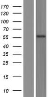 Human TSPYL6 Protein (Over-Expression Lysate Myc-DDK (Flag))
