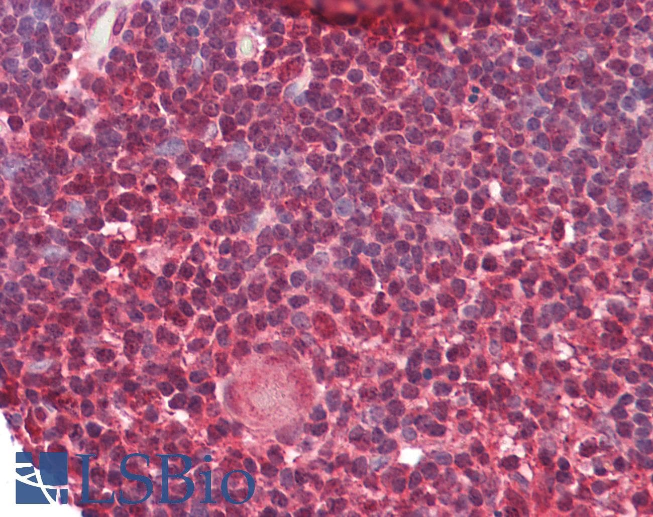 PathPlus™ Polyclonal Rabbit anti-Human HNRNPK / hnRNP K Antibody (aa380-430, IHC)