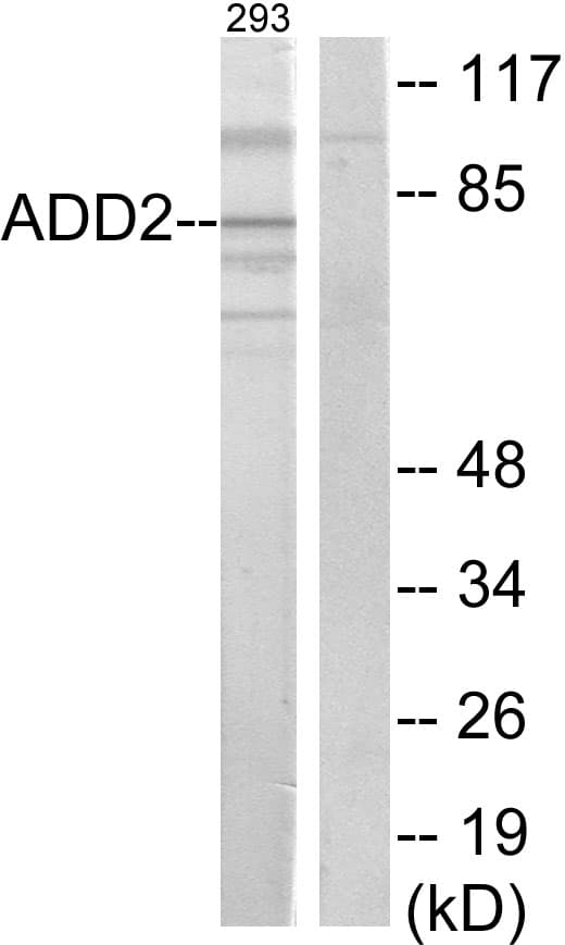 ADD2 Antibody (aa471-520)