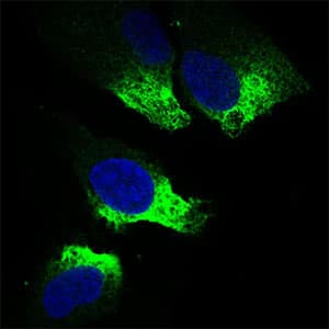 Monoclonal Mouse anti-Human TWIST1 / TWIST Antibody (clone 10E4E6, aa9-74, IHC, IF, WB)