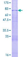 Human MAP2K7 / MEK7 Protein (Recombinant GST)