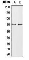 MAPT / Tau Antibody (phospho-Thr498)