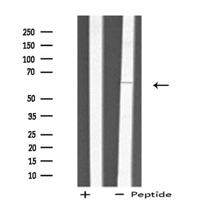 TS / Thromboxane Synthase Antibody