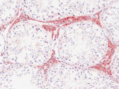 A2M / Alpha-2-Macroglobulin Antibody (clone PSA24)
