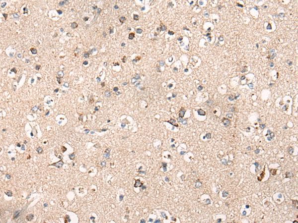 C14orf2 Antibody
