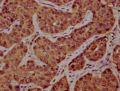 Polyclonal Rabbit anti-Human SSH1 Antibody (IHC, IF)