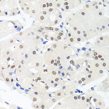 Polyclonal Rabbit anti-Human HMGN1 / HMG14 Antibody (IHC, WB)