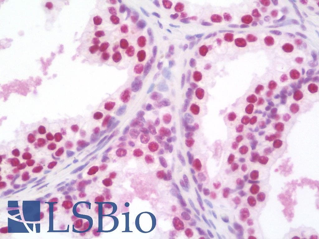 IHC-plus™ SSB / La Antibody (clone 1E11)