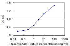 DP97 / DDX54 Antibody (clone 2H6)