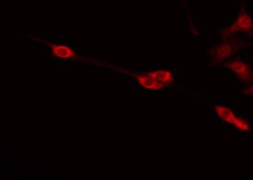 PABPC5 Antibody