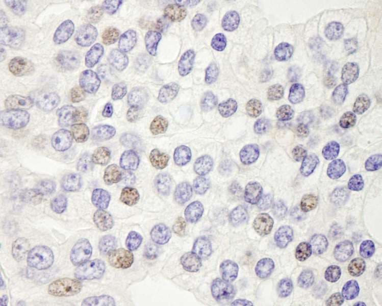 DEK Antibody (aa225-275)