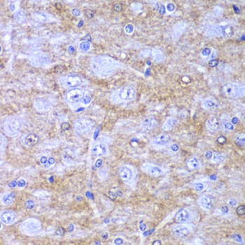 Polyclonal Rabbit anti-Human DDX1 Antibody (IHC, IF, WB)