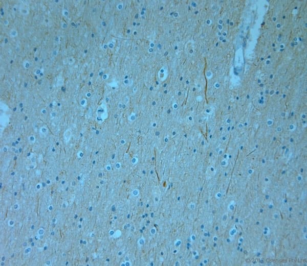 Polyclonal Rabbit anti-Human MPP1 Antibody (aa410-460, IHC)