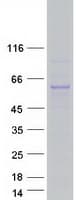 Human TTC39B Protein (Recombinant Myc-DDK (Flag))