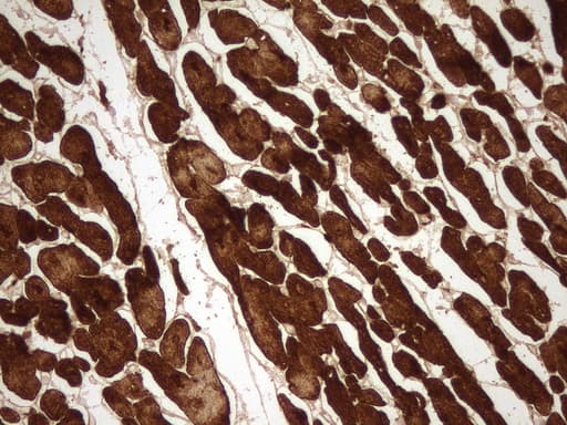 TNNC1 / Cardiac Troponin C Antibody (clone UMAB204)