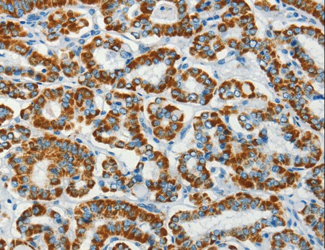 Polyclonal Rabbit anti-Human BCAT2 Antibody (IHC, WB)
