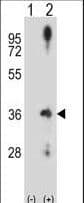 IHC-plus™ CCND2 / Cyclin D2 Antibody (aa1-30)