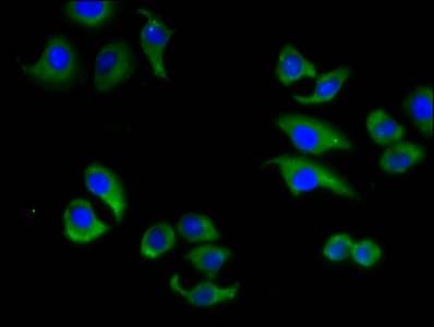 ABCC6 / MRP6 Antibody