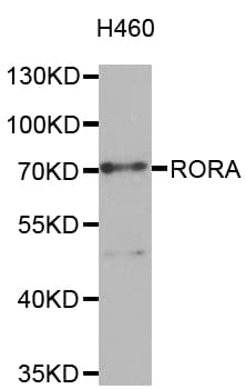 RORA / ROR Alpha Antibody