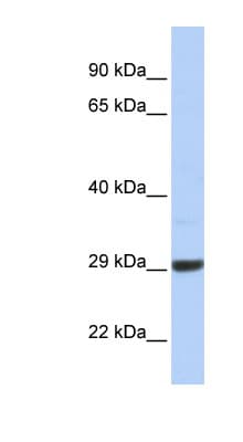Polyclonal Rabbit anti-Human ZCCHC24 Antibody (aa108-157, WB)