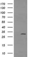 TPSG1 / Tryptase Gamma 1 Antibody (aa20-283, clone OTI4E1)