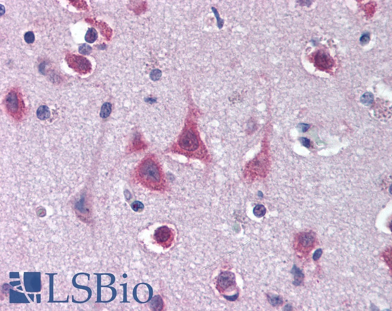 IHC-plus™ MTO1 Antibody (C-Terminus)