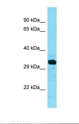 FAM212A Antibody (aa139-188)