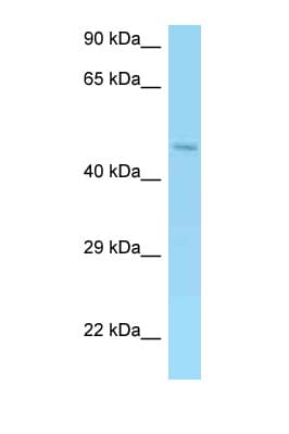 AMACR / P504S Antibody (aa139-188)