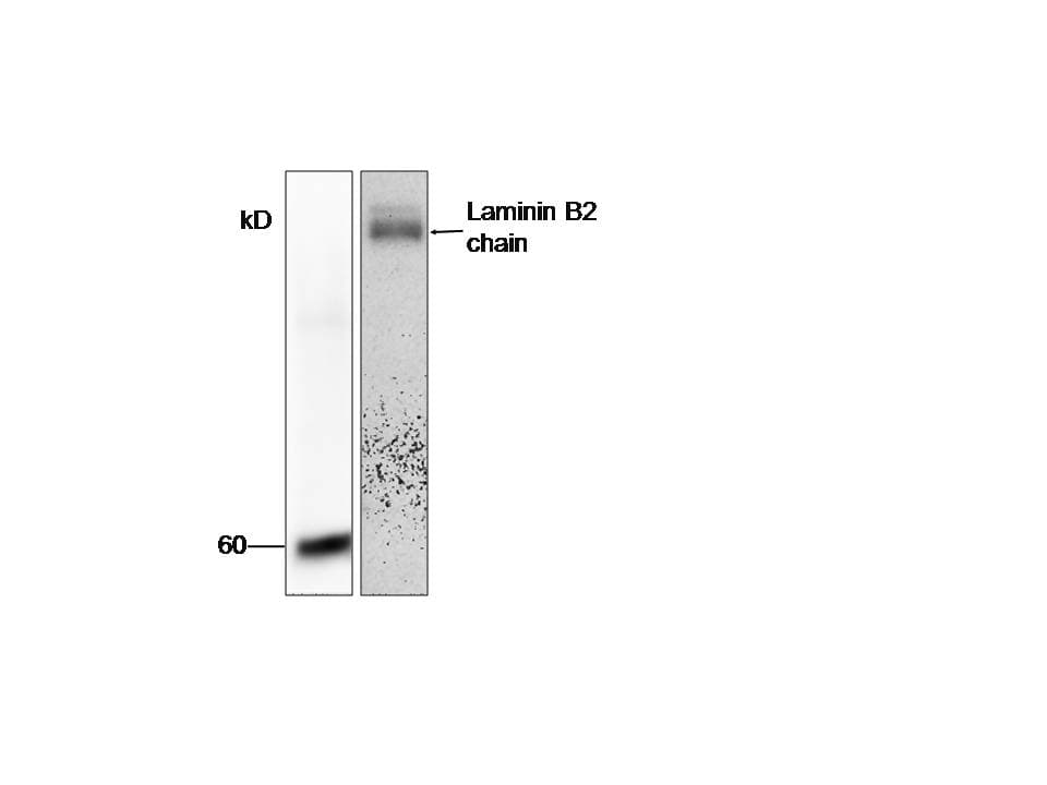 Monoclonal Mouse anti-Human LAMC1 / Laminin Gamma 1 Antibody (aa526-1106, WB)