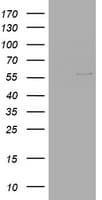 Vimentin Antibody (clone OTI7A9)