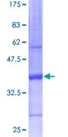 Human SCGB2A2 / Mammaglobin A Protein (Recombinant GST)