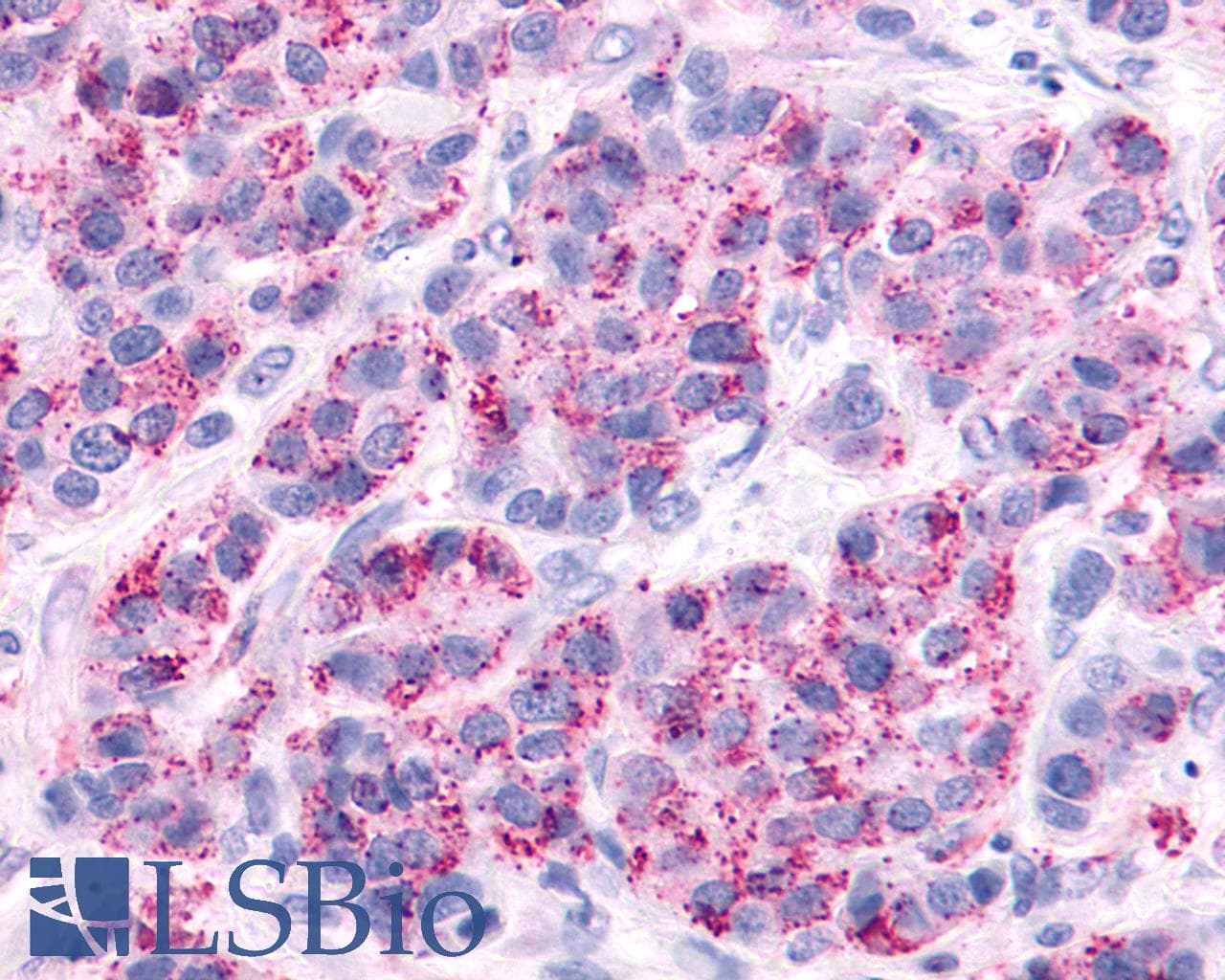 Polyclonal Rabbit anti-Human AVPR2 / V2R Antibody (Cytoplasmic Domain, IHC)