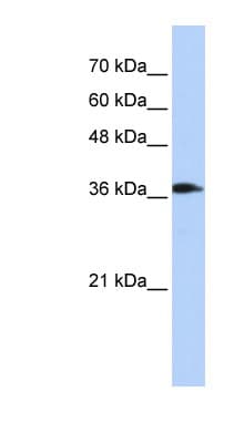 ATP6V0D2 Antibody (C-Terminus)