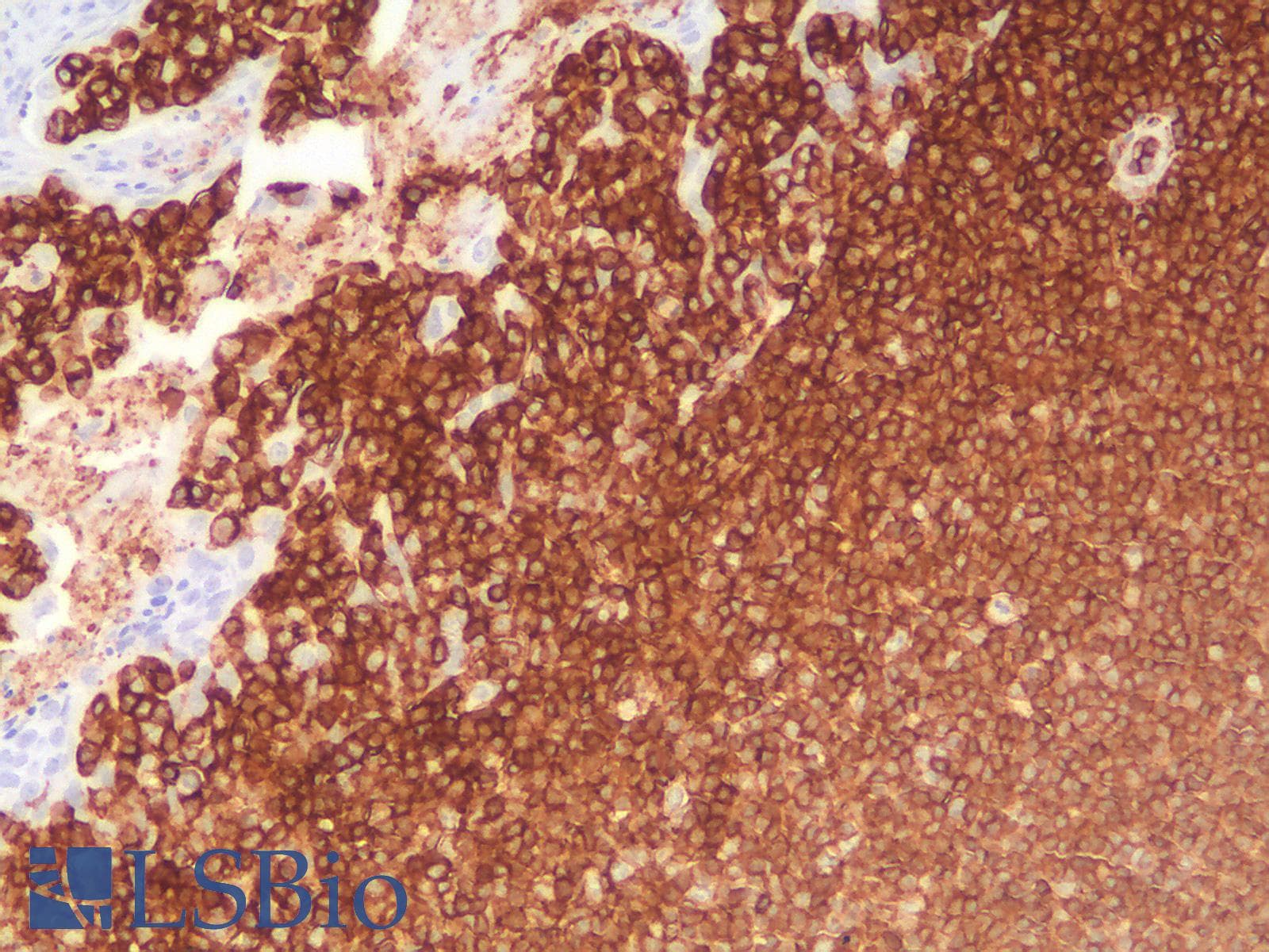PathPlus™ CD45RB Antibody (clone PTPRC/2877R)