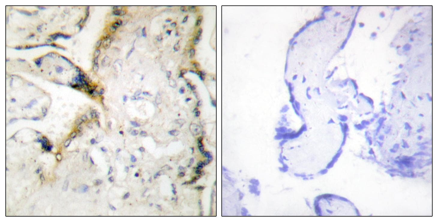 Polyclonal Rabbit anti-Human LAMA2 / Merosin Antibody (IHC, IF)