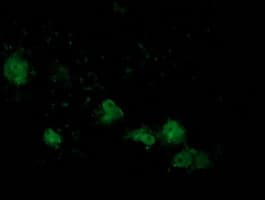 ATP6V1B1 Antibody (clone OTI2D2)