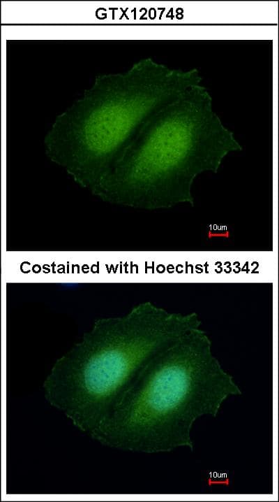 Polyclonal Rabbit anti-Human CBWD1 Antibody (IF, WB)