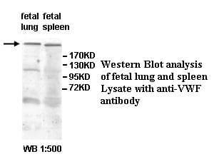 VWF / Von Willebrand Factor Antibody (aa83-199)