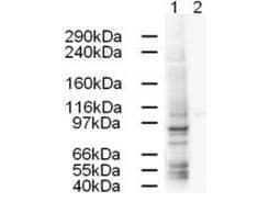 IHC-plus™ AP1G1 / Adaptin Gamma 1 Antibody (aa625-675)