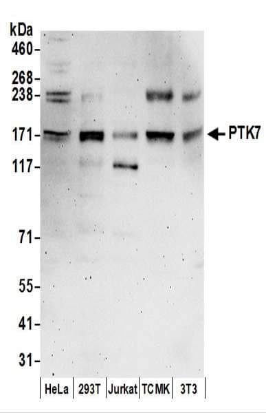 CCK4 / PTK7 Antibody (aa750-800)