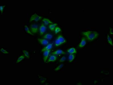 Polyclonal Rabbit anti-Human LRTM1 Antibody (IHC, WB)