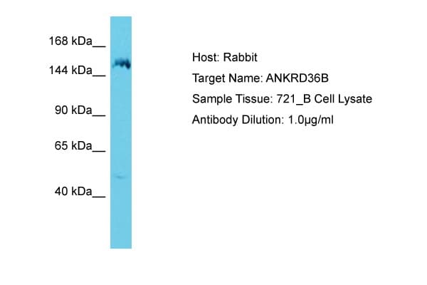 Polyclonal Rabbit anti-Human KIAA1641 Antibody (aa1263-1312, WB)