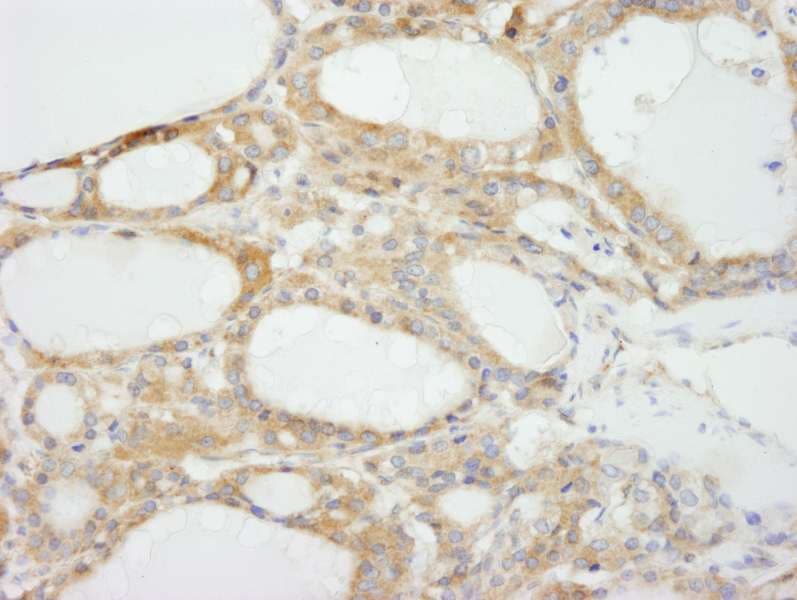 NF2 / Merlin Antibody (aa550-C-term)