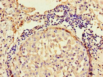 Polyclonal Rabbit anti-Human ANO4 Antibody