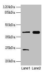 MAP2K3 / MEK3 / MKK3 Antibody