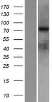 RED2 / ADARB2 Protein (Over-Expression Lysate Myc-DDK (Flag))