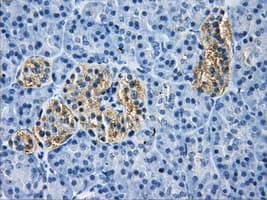 Monoclonal Mouse anti-Human HDAC10 Antibody (clone OTI5E2, IHC, WB)